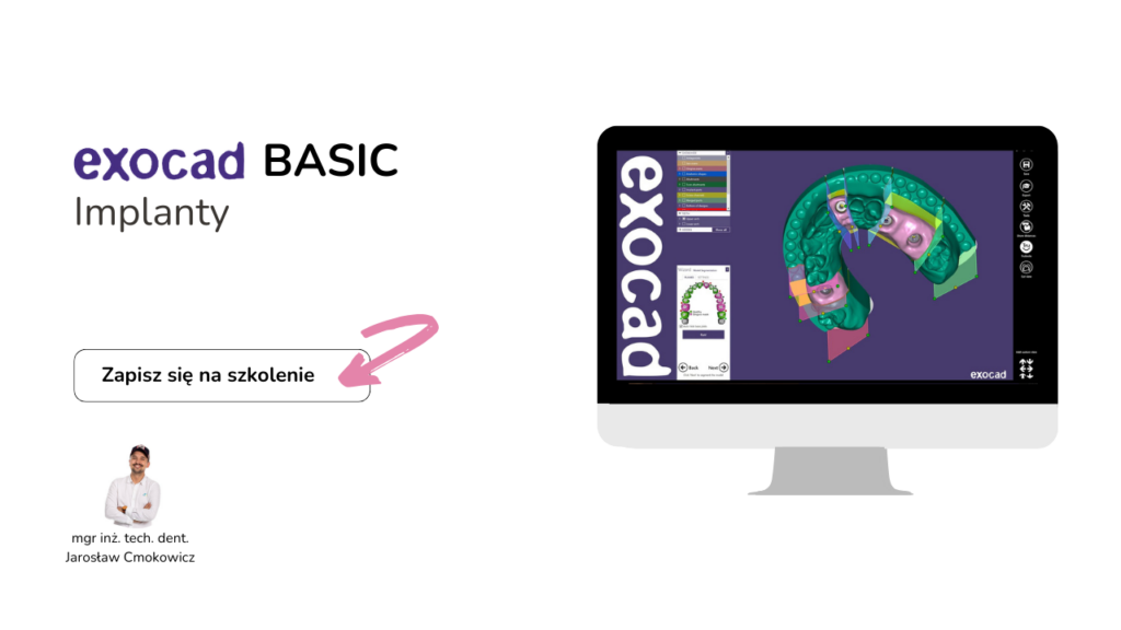 Szkolenie exocad basic implanty