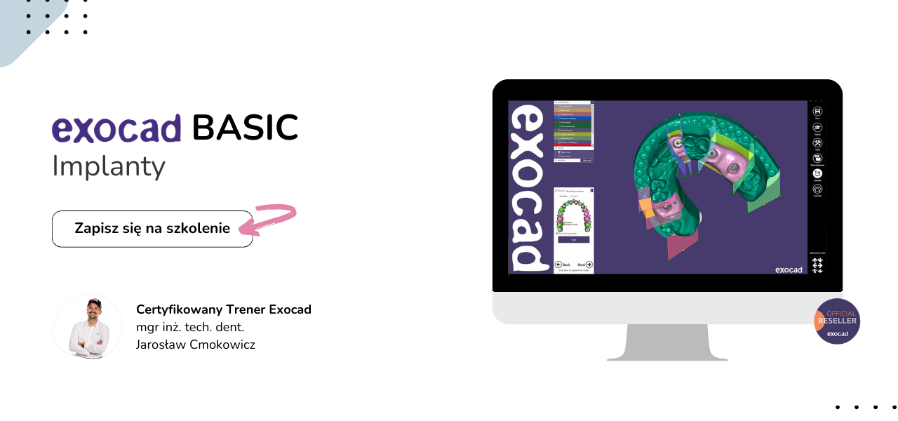 Exocad Basic implanty Szkolenie TAG Dental