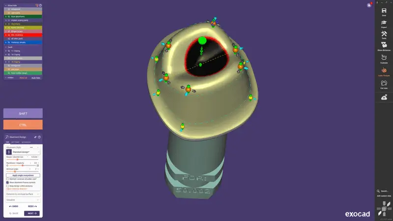 EXOCAD DentalCAD Core - Implanty
