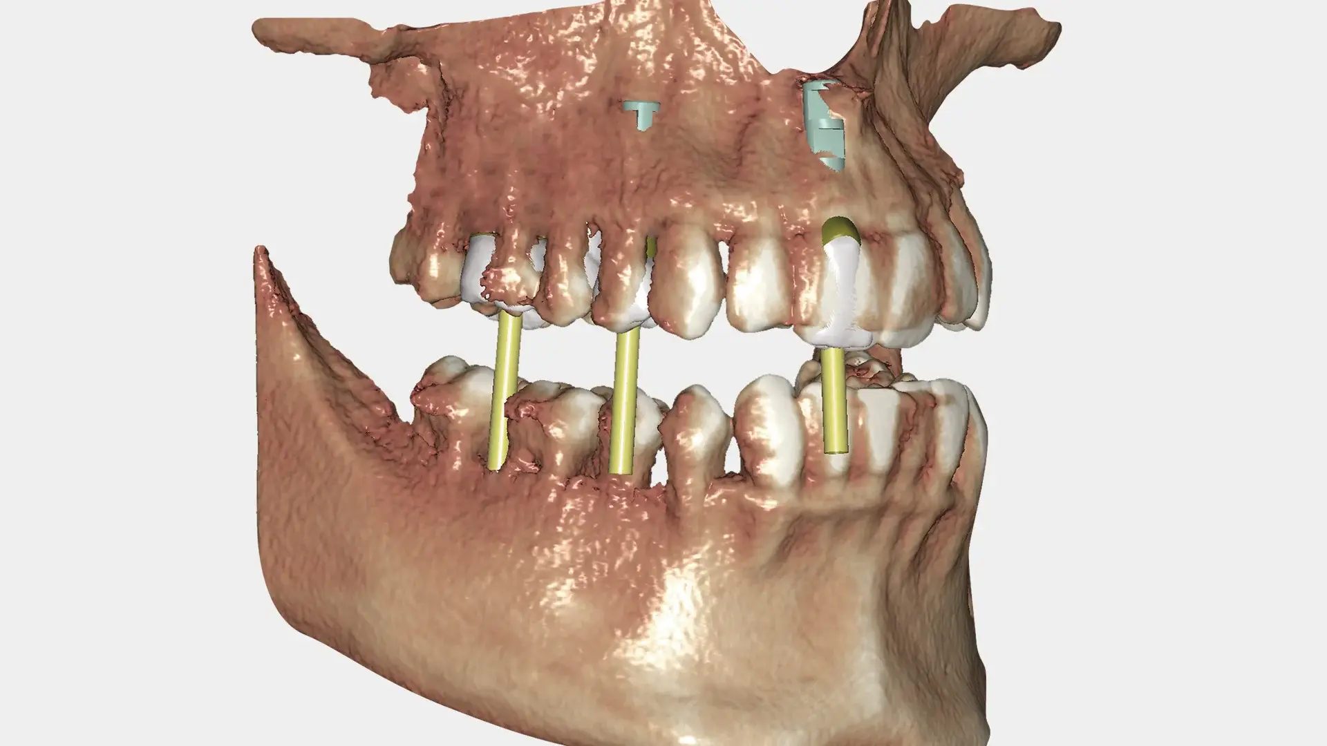 EXOCAD DentalCAD Core - DICOM Viewer