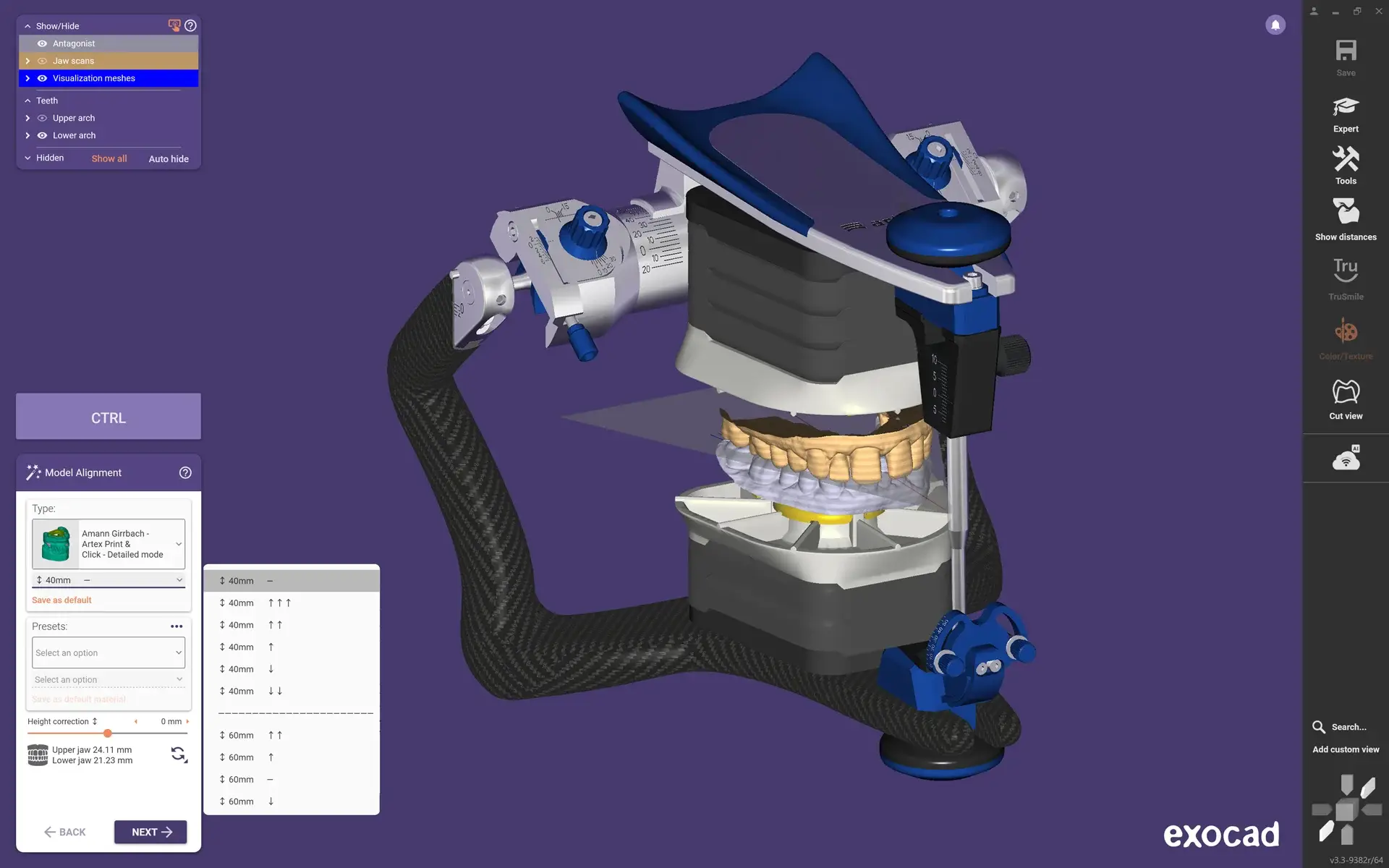 EXOCAD DentalCAD Core - Wirtualny artykulator