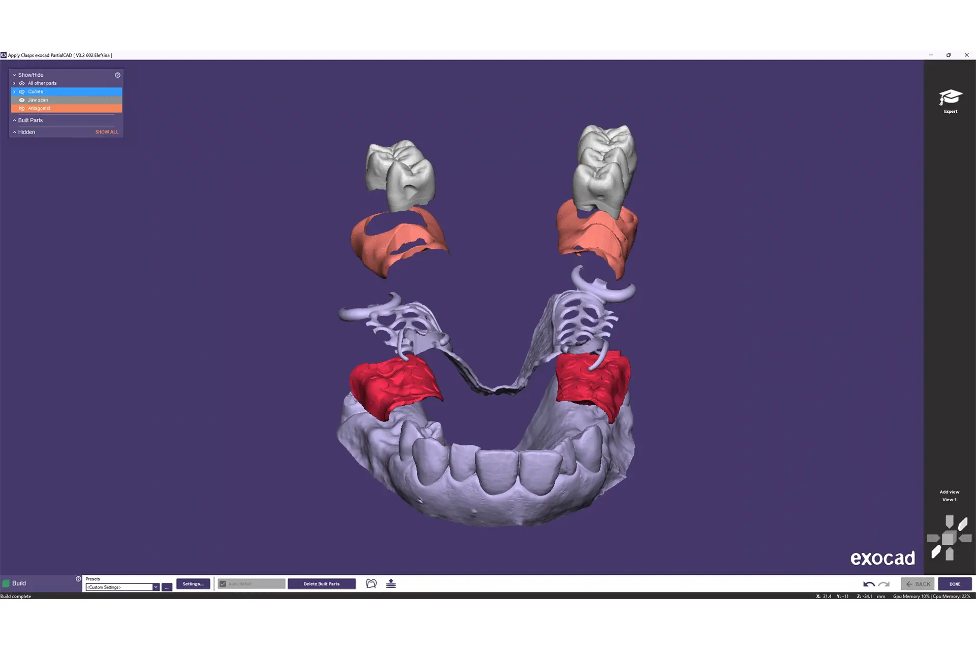 EXOCAD DentalCAD Core - Protezy szkieletowe