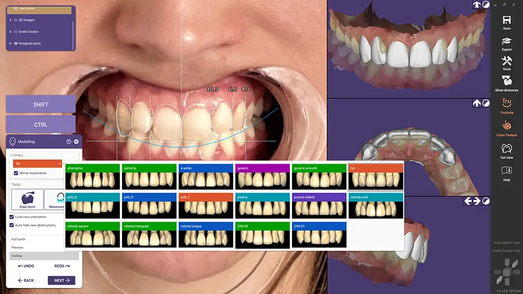 EXOCAD DentalCAD Core - Smile Creator