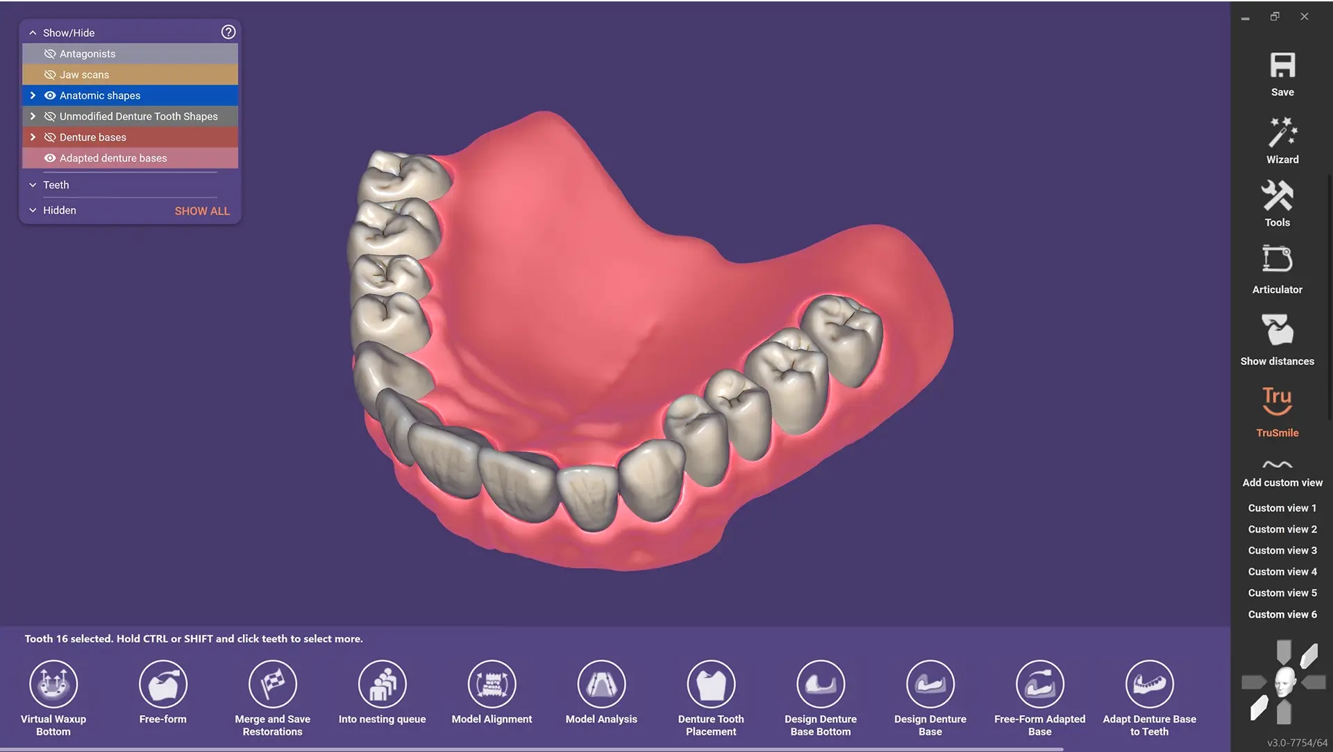 EXOCAD DentalCAD Core - Protezy całkowite