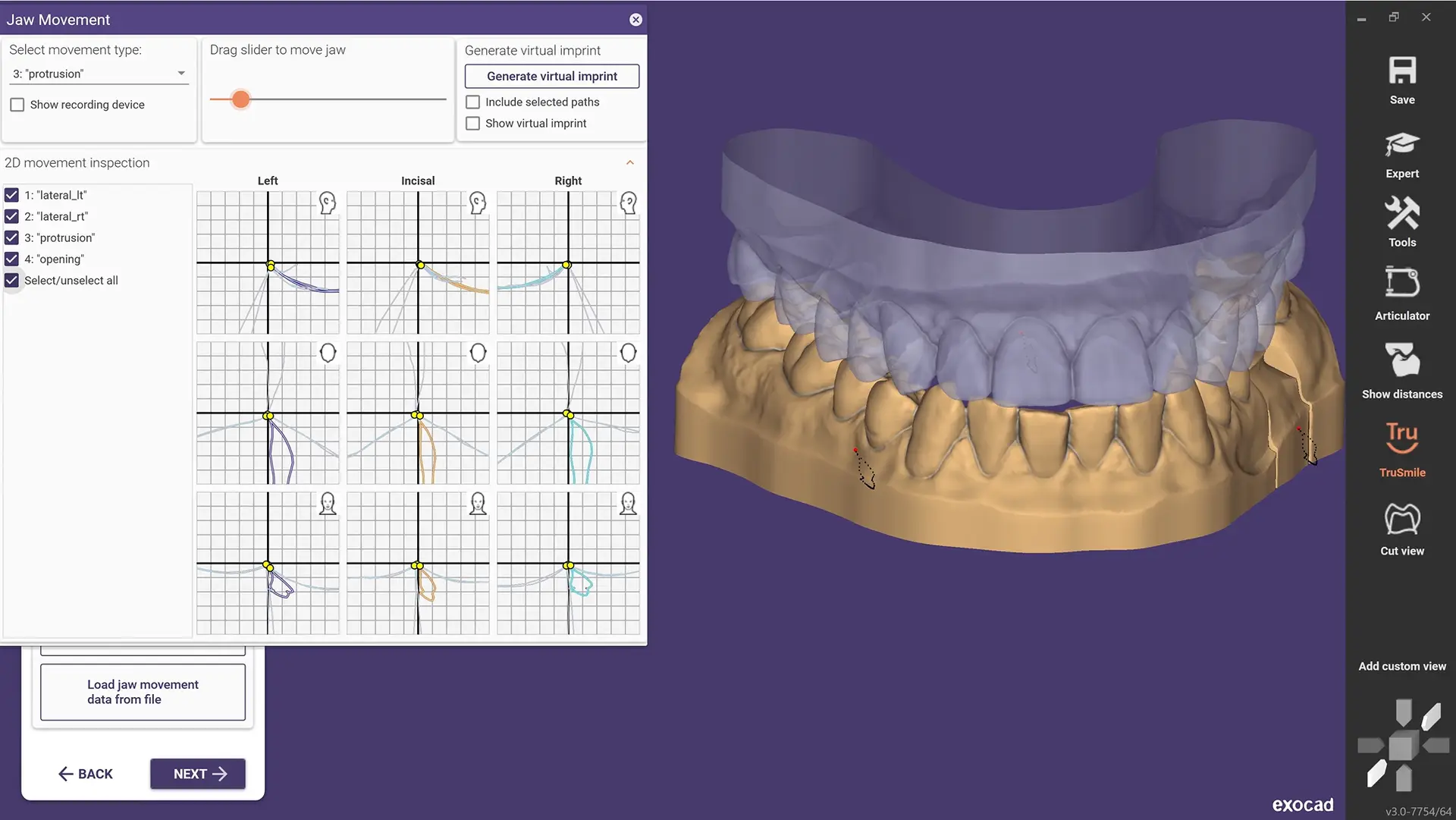 EXOCAD DentalCAD Core - Jaw Motion Import