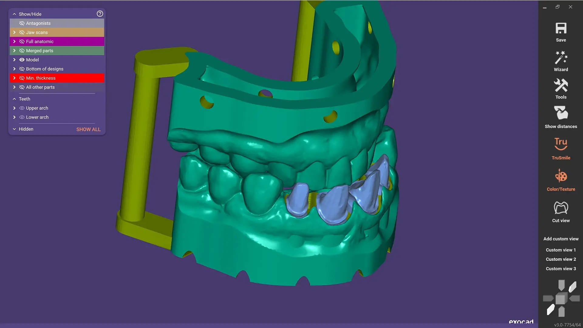 EXOCAD DentalCAD Core - Kreator Modeli