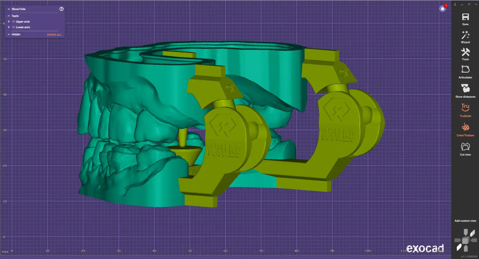EXOCAD DentalCAD Core - xSNAP