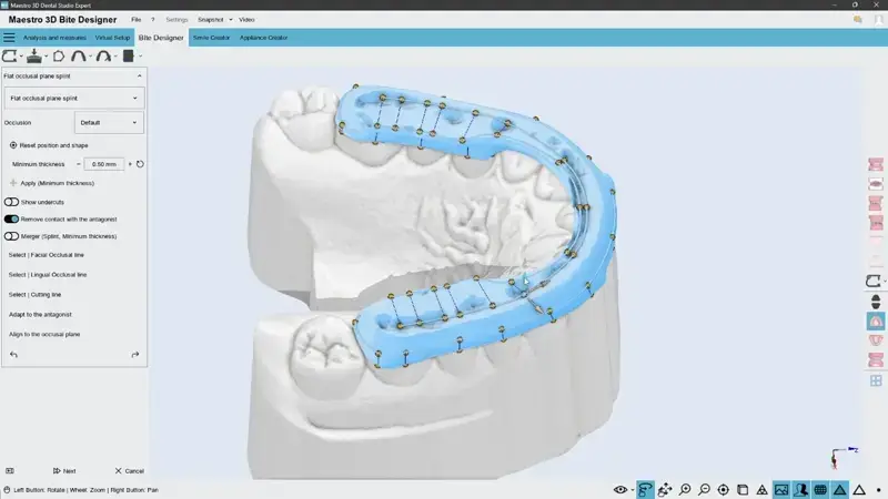 Maestro3D Ortho-Studio | Bite