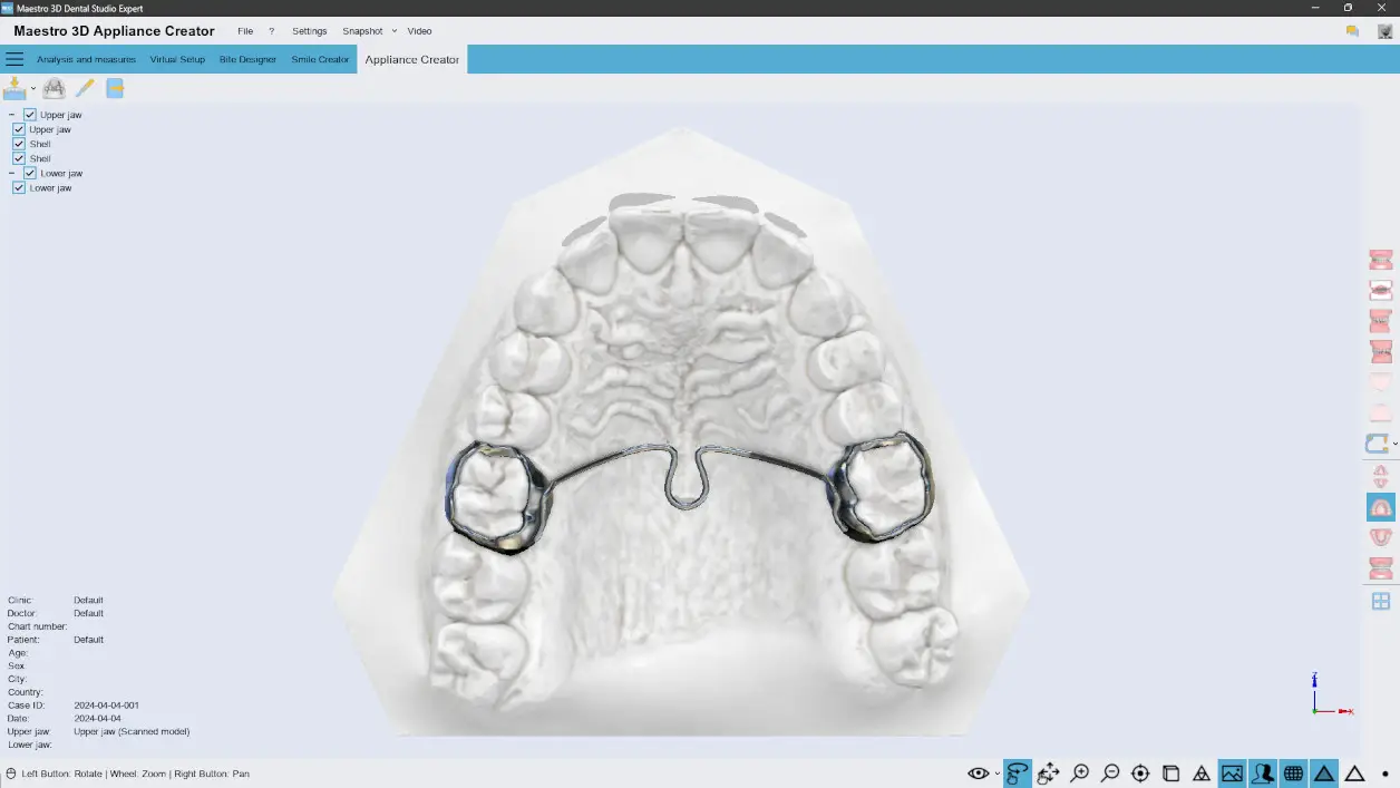 Maestro3D Ortho-Studio | Bite & Appliance
